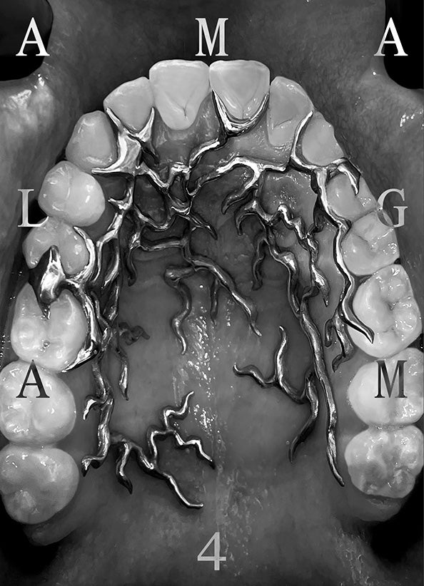 Amalgam — Op.IV